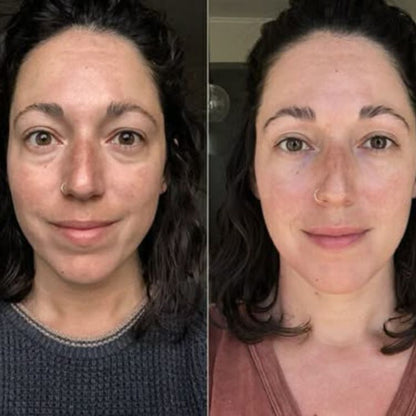 Parches BareHer™  - Reduce las ojeras y Bolsas