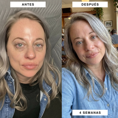 Parches BareHer™  - Reduce las ojeras y Bolsas