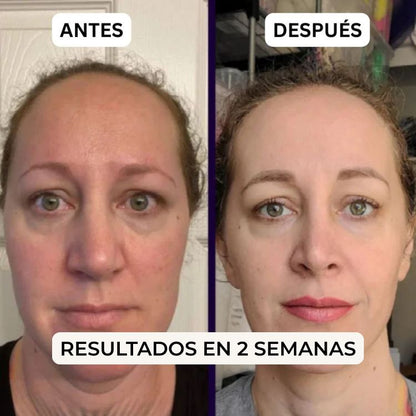 Parches BareHer™  - Reduce las ojeras y Bolsas