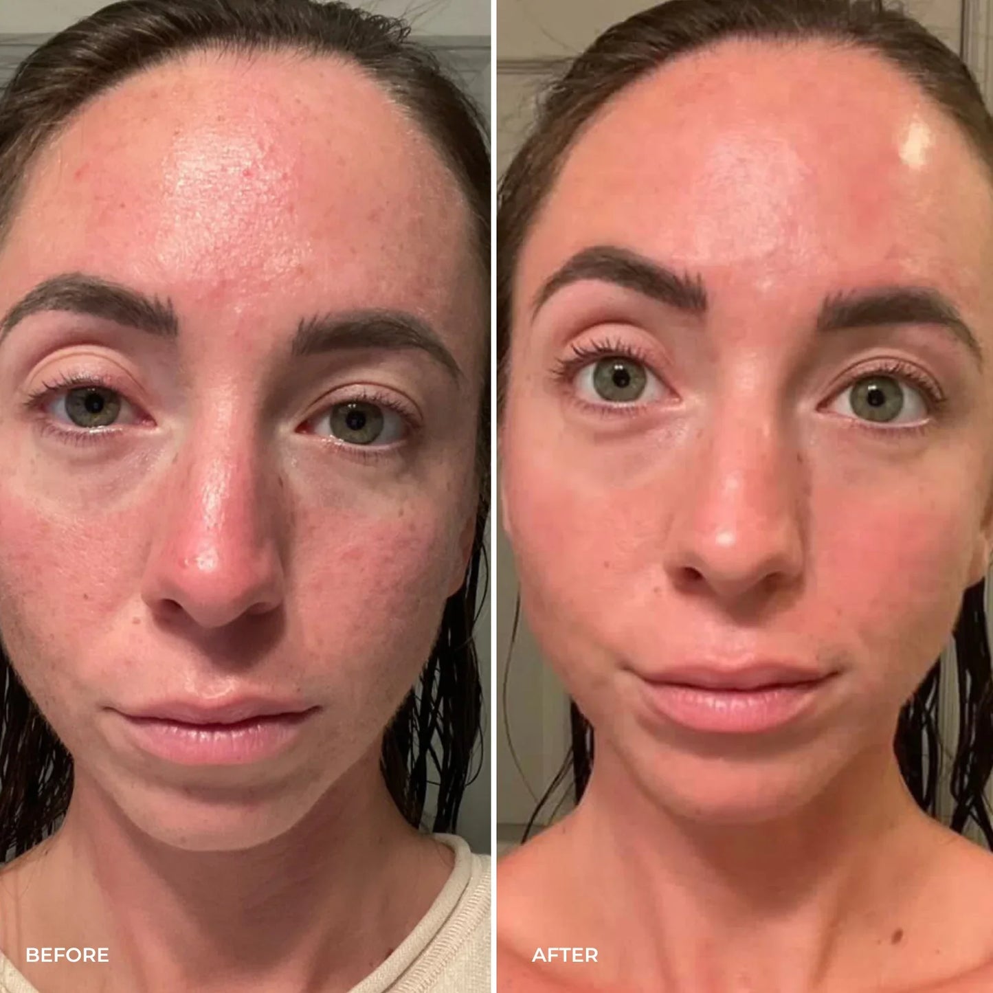 Parches BareHer™  - Reduce las ojeras y Bolsas