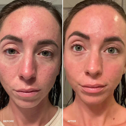 Parches BareHer™  - Reduce las ojeras y Bolsas