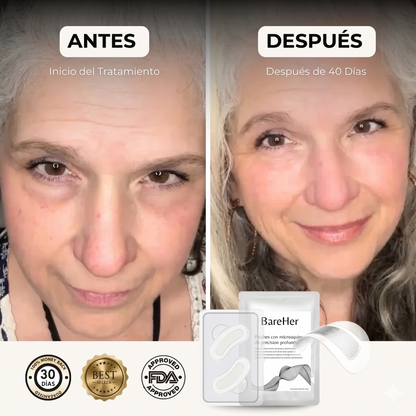 Parches BareHer™  - Reduce las ojeras y Bolsas